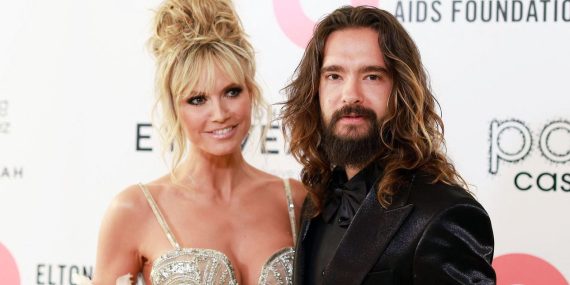 Heidi Klum, kocasının kanını emerek güzelleştiğini söyledi