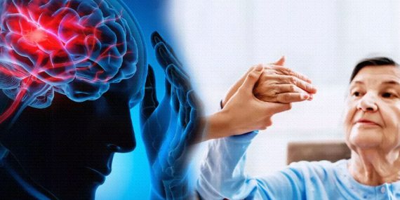 İnme Nedir Nasıl Önlenir