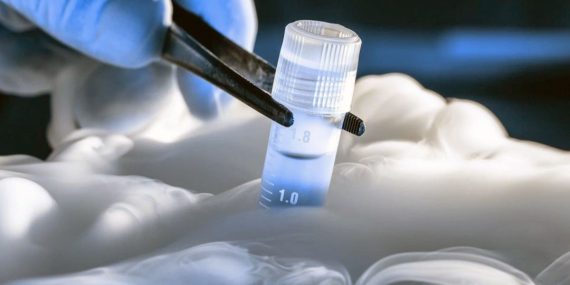 Alabama’da Dondurulmuş Embriyolar “Çocuk” Sayılacak: Üreme Tedavileri ve Hukukta Önemli Değişiklik