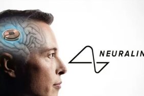 Neuralink İnsan Hastada Fare İmlecini Düşünceyle Kontrol Ettirebildi 5 Elon Musk, Neuralink