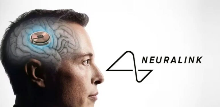 Neuralink İnsan Hastada Fare İmlecini Düşünceyle Kontrol Ettirebildi 1 Elon Musk, Neuralink