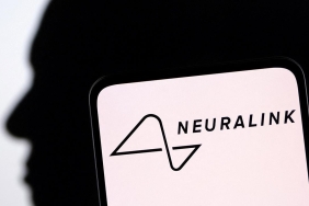 Neuralink İnsan Beyin Çipi İmplantı Operasyonu 2 neuralink-insan-beyin-cipi-implanti-operasyonu-tBNzdu5w.jpg