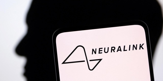 Neuralink İnsan Beyin Çipi İmplantı Operasyonu