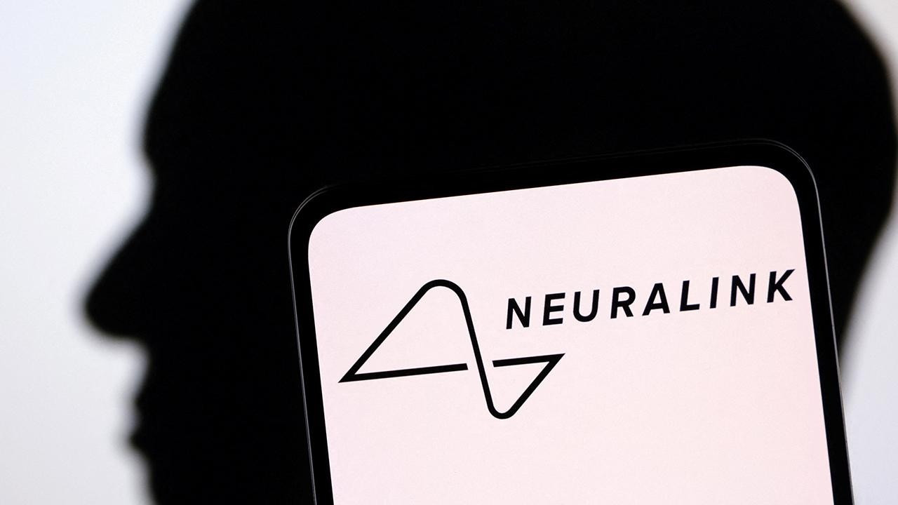 Neuralink İnsan Beyin Çipi İmplantı Operasyonu 2 neuralink-insan-beyin-cipi-implanti-operasyonu-tBNzdu5w.jpg