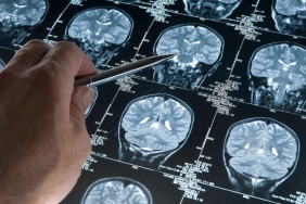 Alzheimer Hastalığı ve Müzik Terapisi 4 alzheimer-hastaligi-ve-muzik-terapisi-P2YzA2Ag.jpg