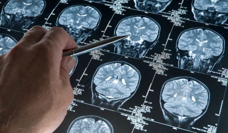 Alzheimer Hastalığı ve Müzik Terapisi 6 alzheimer-hastaligi-ve-muzik-terapisi-P2YzA2Ag.jpg