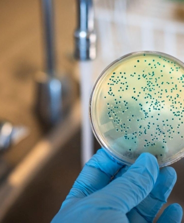 Pseudomonas aeruginosa: Mikropların Sinsi Tehlikesi 9 pseudomonas-aeruginosa-mikroplarin-sinsi-tehlikesi-s4qJMObQ.jpg
