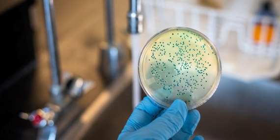 Pseudomonas aeruginosa: Mikropların Sinsi Tehlikesi