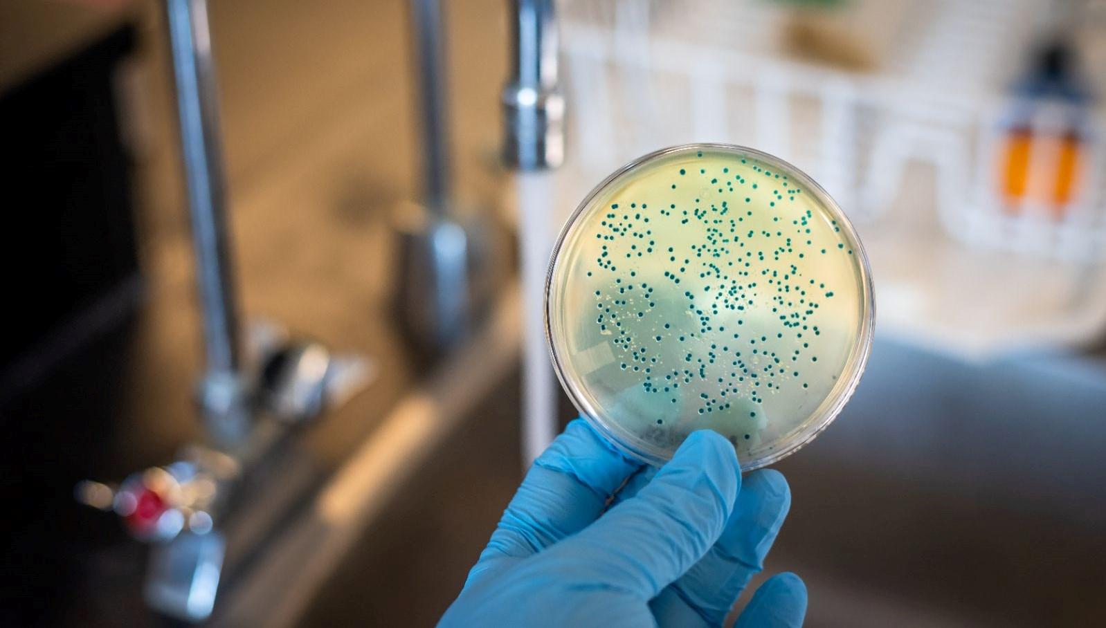 Pseudomonas aeruginosa: Mikropların Sinsi Tehlikesi 2 pseudomonas-aeruginosa-mikroplarin-sinsi-tehlikesi-s4qJMObQ.jpg