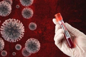 BM Genel Sekreter Sözcüsü'nden Mpox Salgını Uyarısı 5 bm-genel-sekreter-sozcusunden-mpox-salgini-uyarisi-28kC2YFE.jpg