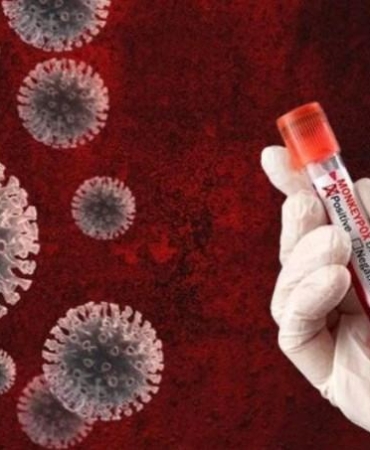 BM Genel Sekreter Sözcüsü'nden Mpox Salgını Uyarısı 3 bm-genel-sekreter-sozcusunden-mpox-salgini-uyarisi-28kC2YFE.jpg
