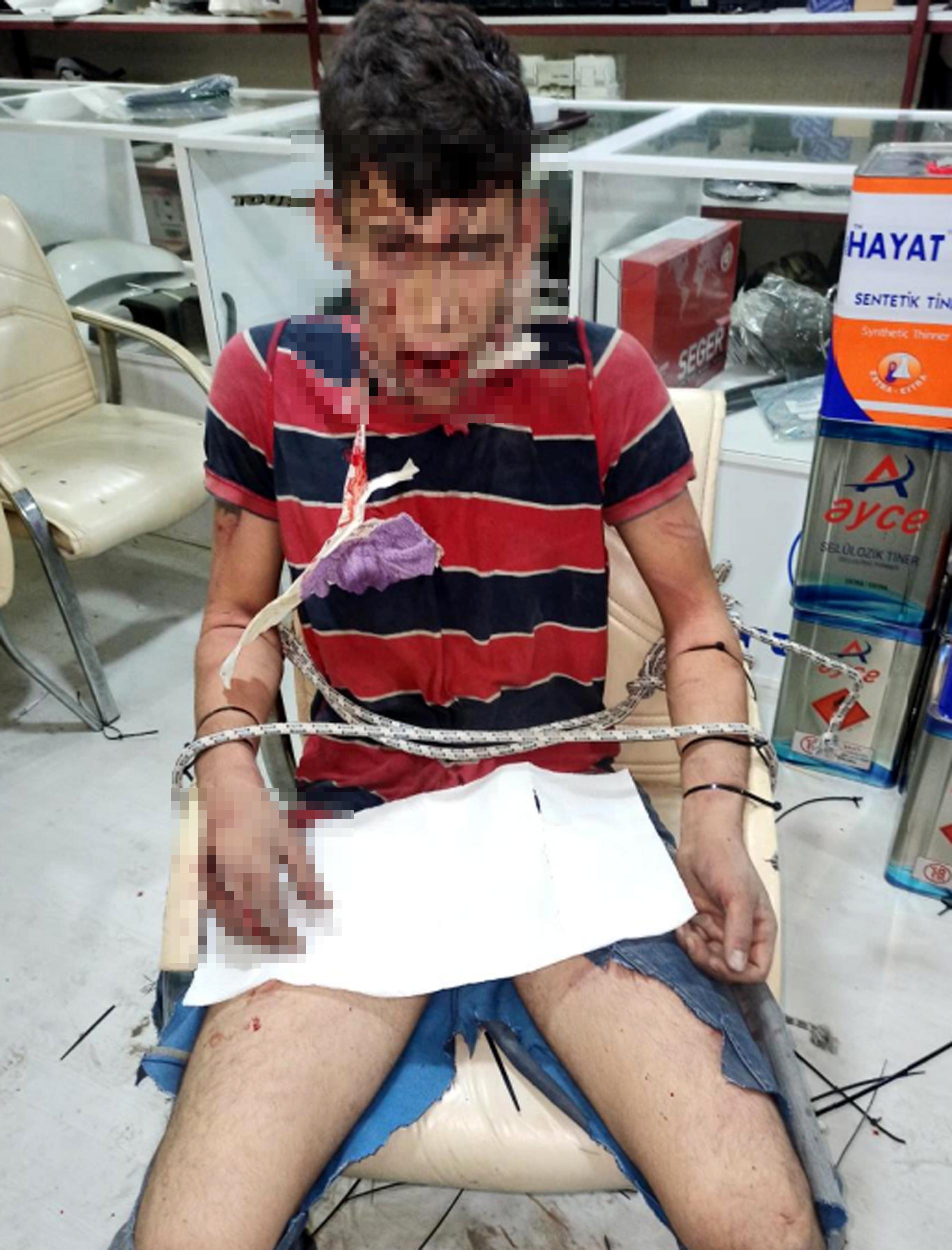 Adalet Arayışı: 3 Gün Süren İşkence ve Böcek Zorbalığı 7 Adalet Arayışı: 3 Gün Süren İşkence ve Böcek Zorbalığı