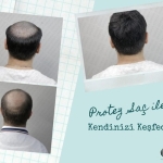 Onna Hair Protez Saç ile Kendinizi Keşfedin! 24 protez-sac-onna-hair