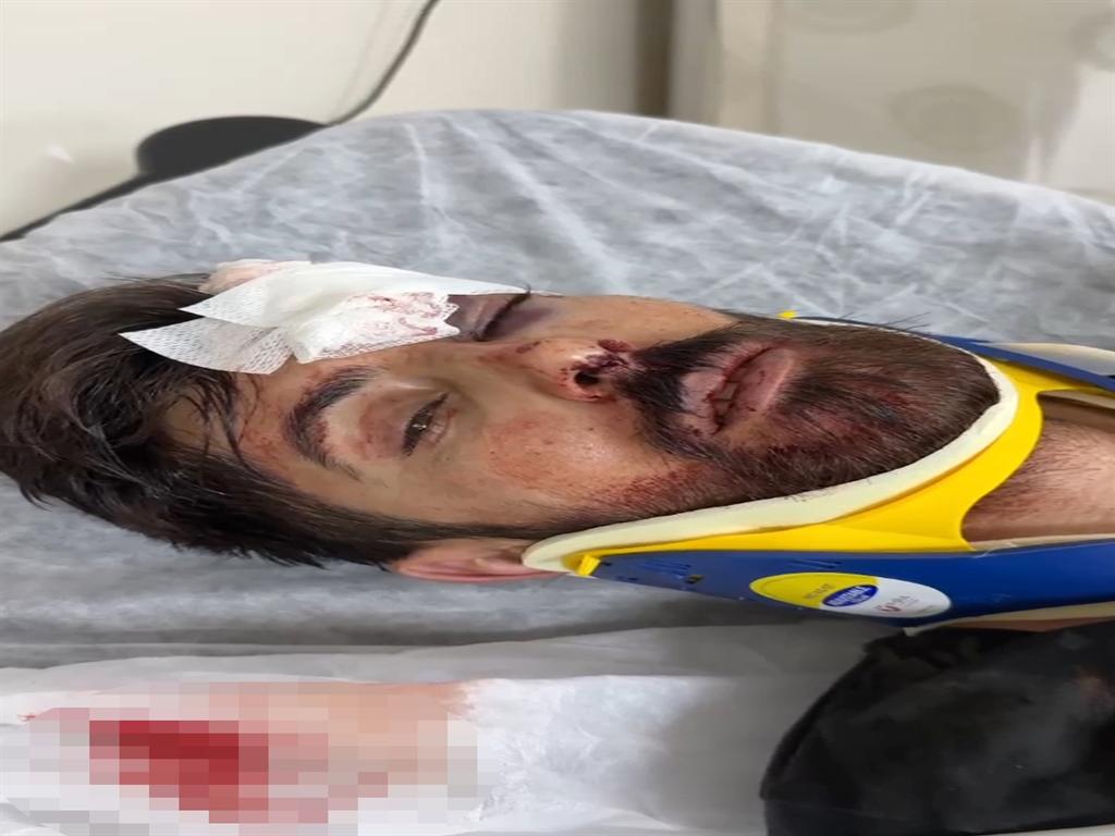 Tek Yumrukla Çiçekiyi Öldüren Şüphelinin Şok Edici İfadesi Gün Yüzüne Çıktı 6 Kıvanç Şensöz'ün İfadesi