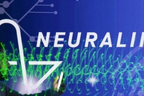 Kanada, İnsan Zihinlerini Değiştirecek Beyin Çipi Denemelerine Neuralink İle Start Verdi! 8 kanada-insan-zihinlerini-degistirecek-beyin-cipi-denemelerine-neuralink-ile-start-verdi-H6ux4u4v.jpg