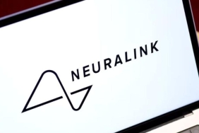 Musk ve SEC Arasındaki Neuralink Çatışması: Zihin Okuma ve Yasal Çekişmenin Ardındaki Sır! 1 musk-ve-sec-arasindaki-neuralink-catismasi-zihin-okuma-ve-yasal-cekismenin-ardindaki-sir-rhlDG2TF.jpg