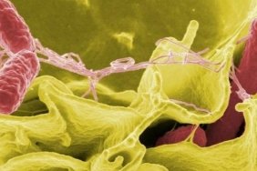 Salmonella: Bulaşma Yolları ve Belirtileri Hakkında Bilmeniz Gerekenler 4 salmonella-bulasma-yollari-ve-belirtileri-hakkinda-bilmeniz-gerekenler-RwEF3uzm.jpg