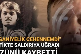 West End Yıldızının Trajik Trafik Saldırısı: Sağ Gözü Gözden Kaybetti 6 west-end-yildizinin-trajik-trafik-saldirisi-sag-gozu-gozden-kaybetti-I2eASKjh.jpg