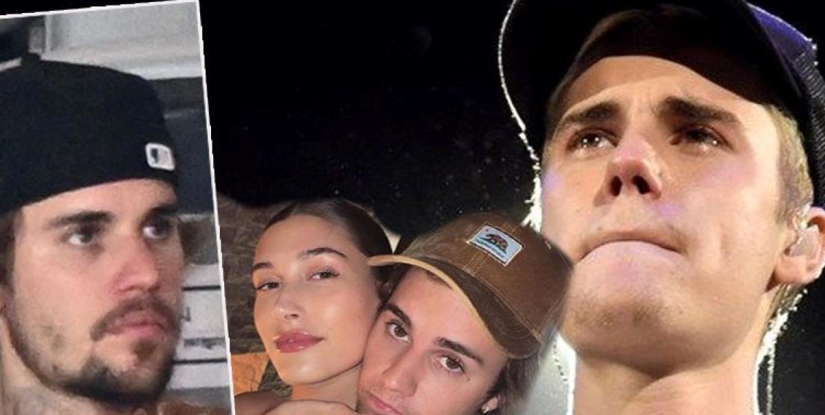 Justin Bieber'ın Yüzündeki Şaşırtıcı Değişim: Hayranlar Endişeli! 5 justin-bieberin-yuzundeki-sasirtici-degisim-hayranlar-endiseli-qXUbcWMy.jpg