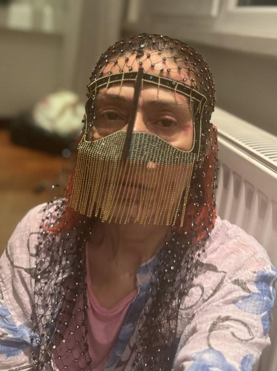Yıldız Tilbe'nin Yanık Yüzüyle Maskeli Pozu Dikkat Çekti 2 Yanıkların Arkasındaki Gerçek