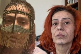 Yıldız Tilbe'nin Yanık Yüzüyle Maskeli Pozu Dikkat Çekti 5 yildiz-tilbenin-yanik-yuzuyle-maskeli-pozu-dikkat-cekti-mBmSdxzn.jpg