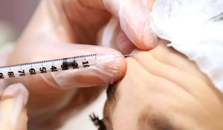 Botoks Sadece Estetik İçin Değil: Felç, Serebral Palsi ve Migren Tedavisinde Kullanılıyor 1 botoks-sadece-estetik-icin-degil-felc-serebral-palsi-ve-migren-tedavisinde-kullaniliyor-FLWkb5kl.jpg