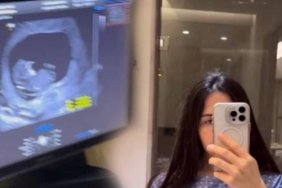 Fenomen Özlem Öz'den Üzücü Haber: Bebek Acısını Paylaştı ve Kaybının Sebebini Açıkladı 4 fenomen-ozlem-ozden-uzucu-haber-bebek-acisini-paylasti-ve-kaybinin-sebebini-acikladi-Y3Z72Vmw.jpg