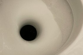 Korkunç Gerçek: Kabızlık Şikayetiyle Hastaneye Giden Hastanın Hayatı Saniyeler İçinde Değişti! 2 korkunc-gercek-kabizlik-sikayetiyle-hastaneye-giden-hastanin-hayati-saniyeler-icinde-degisti-vOYBF5GN.jpg