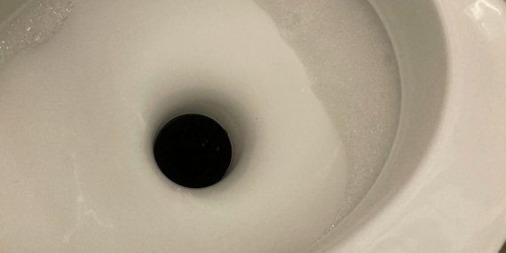 Korkunç Gerçek: Kabızlık Şikayetiyle Hastaneye Giden Hastanın Hayatı Saniyeler İçinde Değişti!