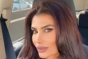 Şarkıcı Hatice Botoks Sonrası Zehirlenme Belirtileri Yaşadı: "Estetik İçin Değil, Sağlık İçindi" 4 sarkici-hatice-botoks-sonrasi-zehirlenme-belirtileri-yasadi-estetik-icin-degil-saglik-icindi-OgziC98M.jpg