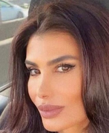 Şarkıcı Hatice Botoks Sonrası Zehirlenme Belirtileri Yaşadı: "Estetik İçin Değil, Sağlık İçindi" 7 sarkici-hatice-botoks-sonrasi-zehirlenme-belirtileri-yasadi-estetik-icin-degil-saglik-icindi-OgziC98M.jpg
