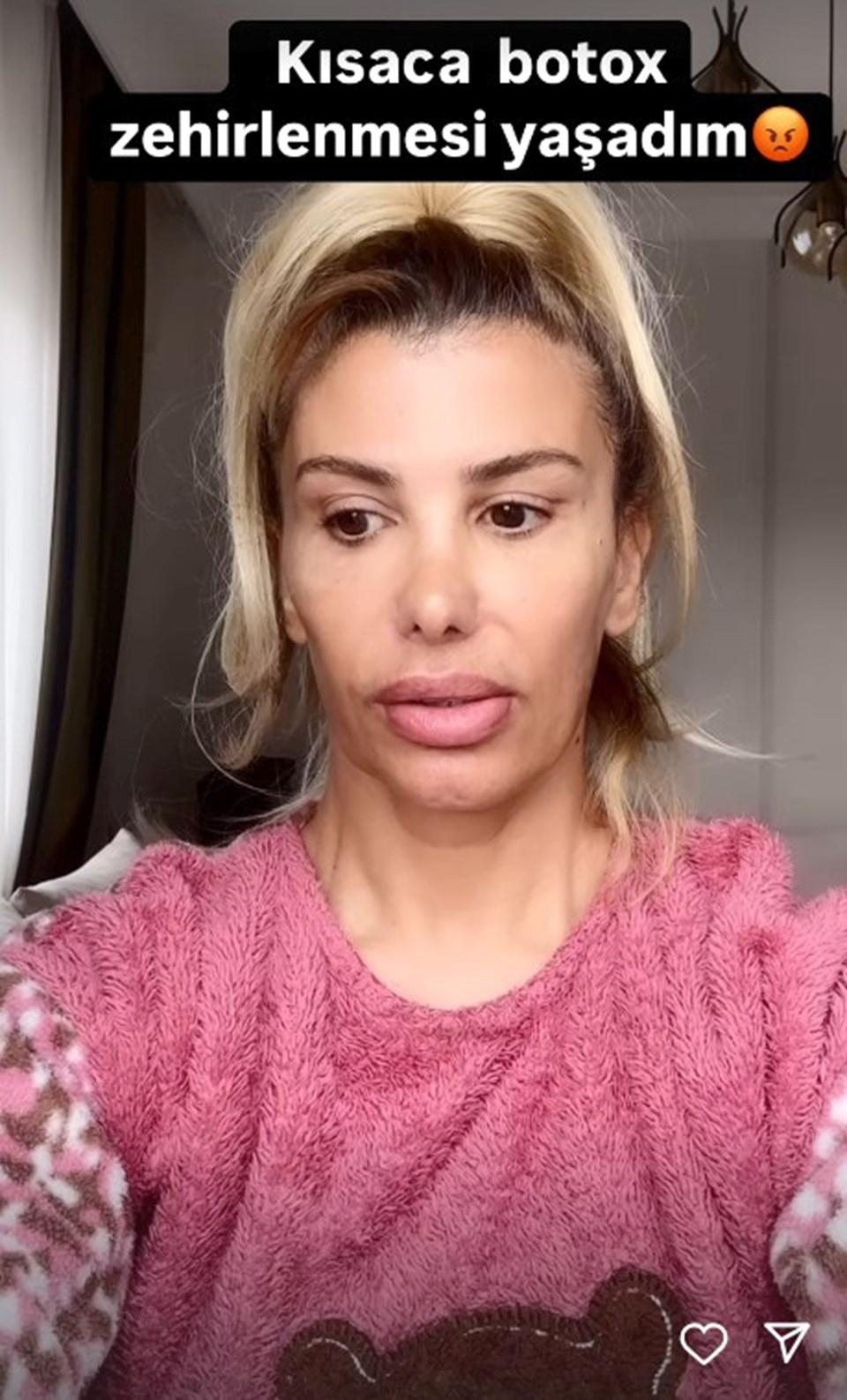 Şarkıcı Hatice'nin Botoks Zehirlenmesi: Zor Günlerini Paylaştı 1 Hatice'nin Botoks Deneyimi ve Yaşadığı Sorunlar