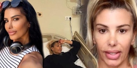 Şarkıcı Hatice’nin Botoks Zehirlenmesi: Zor Günlerini Paylaştı