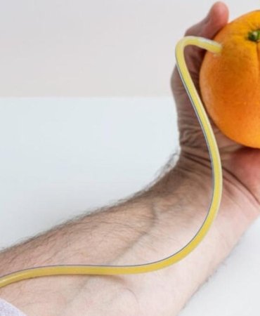 C Vitamini Eksikliği Hayati Tehdit: Skorbüt Hâlâ Geri Dönebiliyor! 3 c-vitamini-eksikligi-hayati-tehdit-skorbut-h-l-geri-donebiliyor-iTbxZS2W.jpg