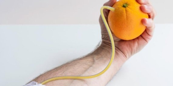 C Vitamini Eksikliği Hayati Tehdit: Skorbüt Hâlâ Geri Dönebiliyor!
