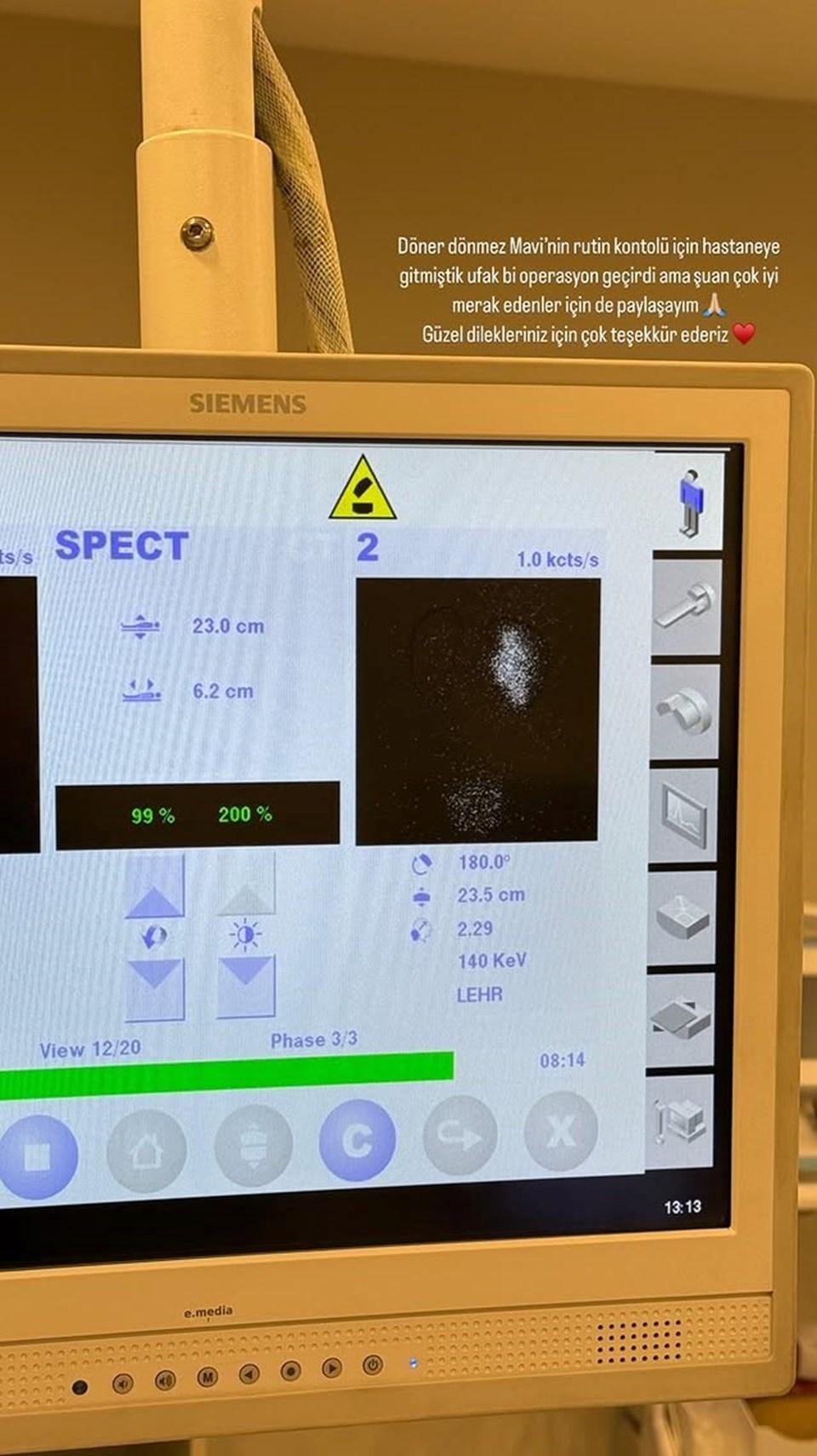Hande Erçelin'in Yeğenine Gerçekleştirilen Operasyon Hakkında Güncel Bilgiler 2 Mavi ile Anılar ve Aile Bağları