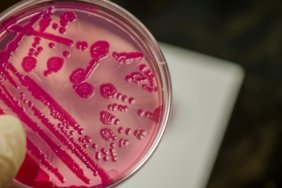 Salmonella Uyarısı: Yaz Aylarında Tavuk ve Süt Ürünlerine Dikkat! 5 salmonella-uyarisi-yaz-aylarinda-tavuk-ve-sut-urunlerine-dikkat-tmNfCnGa.jpg