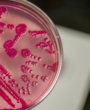Salmonella Uyarısı: Yaz Aylarında Tavuk ve Süt Ürünlerine Dikkat! 2 salmonella-uyarisi-yaz-aylarinda-tavuk-ve-sut-urunlerine-dikkat-tmNfCnGa.jpg