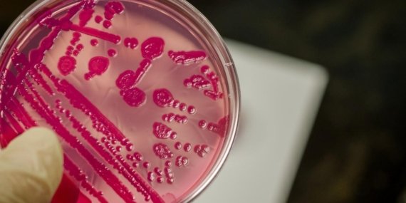 Salmonella Uyarısı: Yaz Aylarında Tavuk ve Süt Ürünlerine Dikkat!