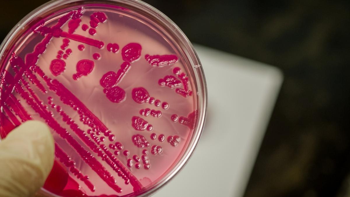 salmonella-uyarisi-yaz-aylarinda-tavuk-ve-sut-urunlerine-dikkat-tmNfCnGa.jpg