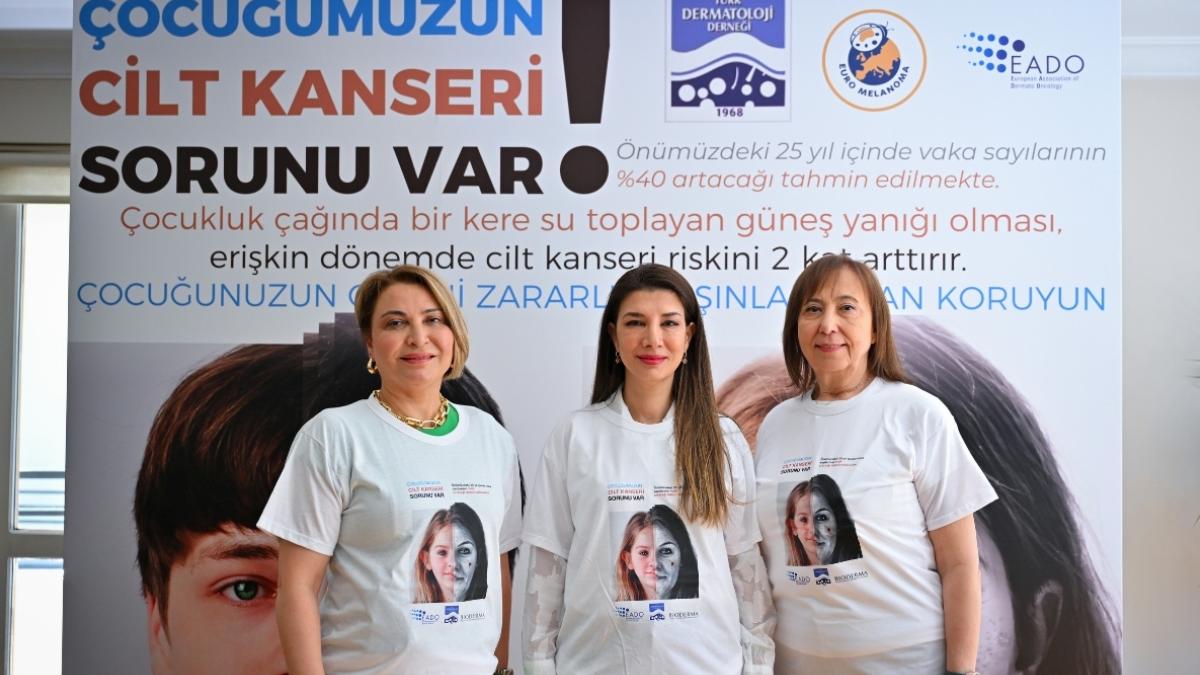 Cilt kanserine karşı Türkiye çapında taramalar başladı, bu yıl odakta çocuklar var 2 cilt-kanserine-karsi-turkiye-capinda-taramalar-basladi-bu-yil-odakta-cocuklar-var-7j2EF3Yj.jpg