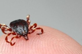 KKKA şüphesi iki can aldı Tunceli ve Tokat’ta ölüm vakaları artıyor 1 kkka-suphesi-iki-can-aldi-tunceli-ve-tokatta-olum-vakalari-artiyor-JxGt8InW.jpg