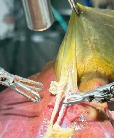 Doktorlara kötü haber: Bir robot, insan gibi ameliyat yapmayı başardı! 3 doktorlara-kotu-haber-bir-robot-insan-gibi-ameliyat-yapmayi-basardi-JaxtAfqW.jpg