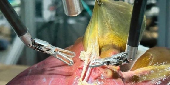 Doktorlara kötü haber: Bir robot, insan gibi ameliyat yapmayı başardı!