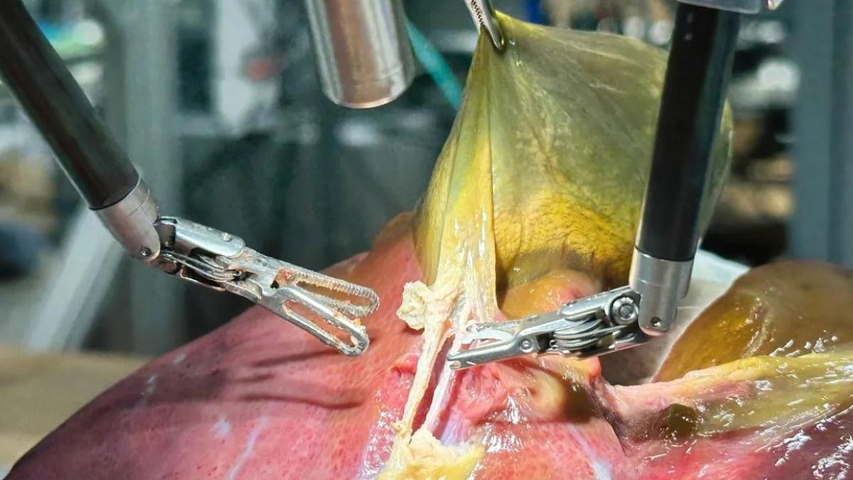 Doktorlara kötü haber: Bir robot, insan gibi ameliyat yapmayı başardı! 2 doktorlara-kotu-haber-bir-robot-insan-gibi-ameliyat-yapmayi-basardi-JaxtAfqW.jpg