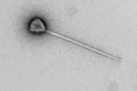 Kuyruğuyla Rekor Kıran Dev Virüs Keşfedildi 5 kuyruguyla-rekor-kiran-dev-virus-kesfedildi-d56cp2ex.jpg