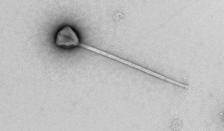 Kuyruğuyla Rekor Kıran Dev Virüs Keşfedildi 6 kuyruguyla-rekor-kiran-dev-virus-kesfedildi-d56cp2ex.jpg