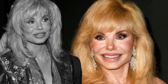Loni Anderson’un Ani Vefatı Şaşkınlık Yarattı: 80 Yaşında Salgın Gibi Yayılan Kanser Haberi