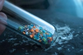 Mikroplastikler insan beynine kadar sızdı: Etkileri neler? 6 mikroplastikler-insan-beynine-kadar-sizdi-etkileri-neler-w7UbjFMB.jpg