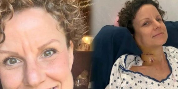 Yüzdeki Farklılık ve Uzun Bir Umut Yolculuğu: Nadiren Görülen Bir Kanserle Mücadele